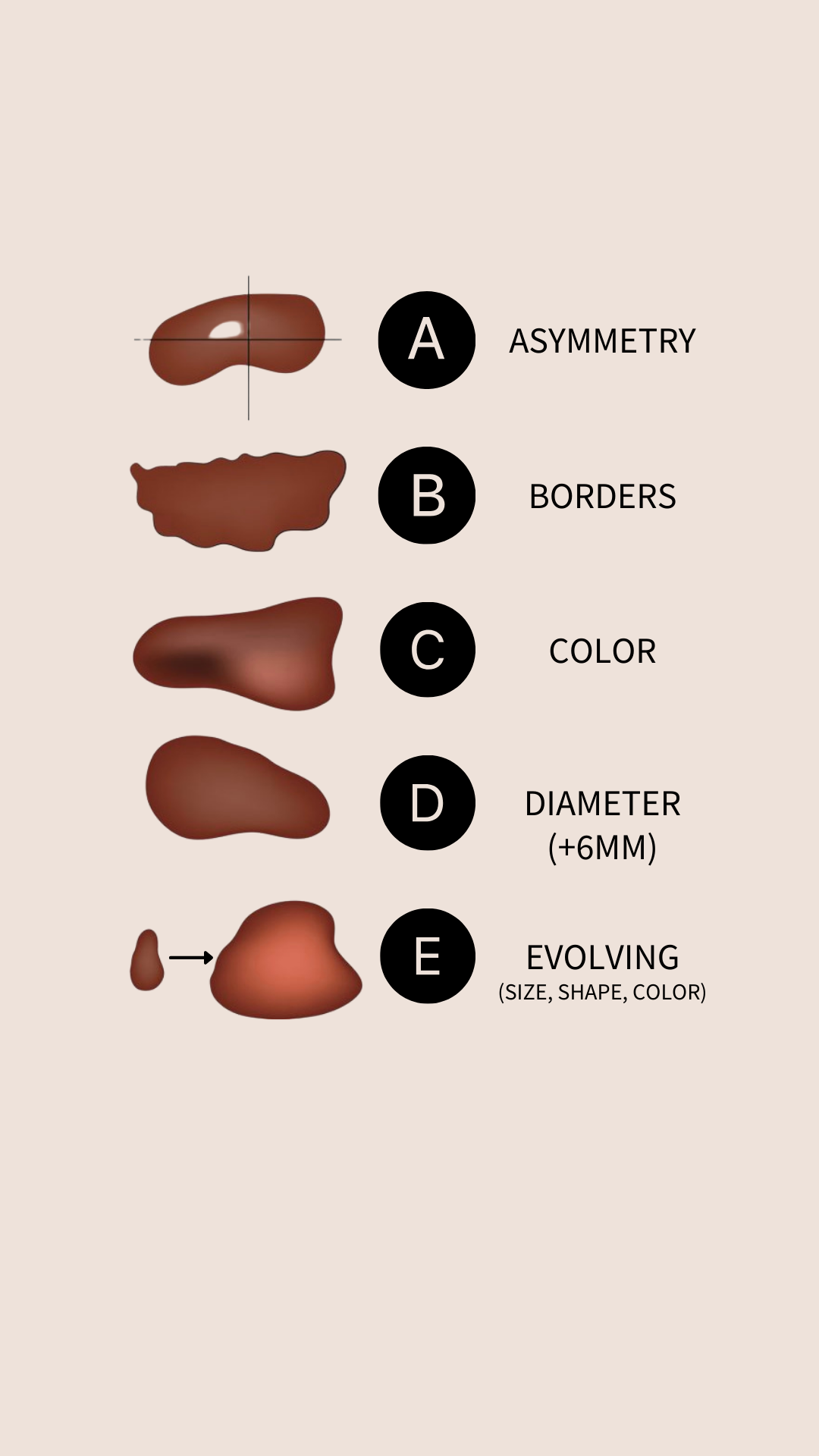 SKIN CANCER CHECK